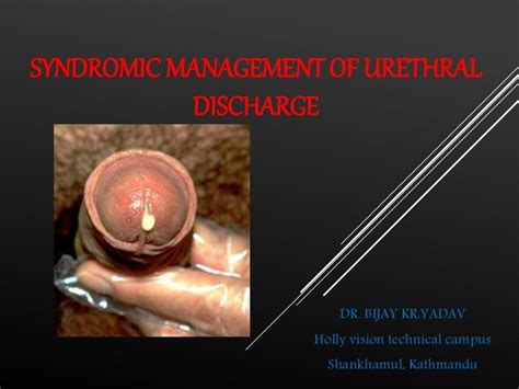 Urethral syndrome is also known as symptomatic abacteriuria. . Pictures of swollen urethra